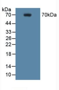 Polyclonal Antibody to Cyclooxygenase-2 (COX 2)