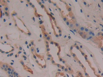 Polyclonal Antibody to Cyclooxygenase-2 (COX 2)