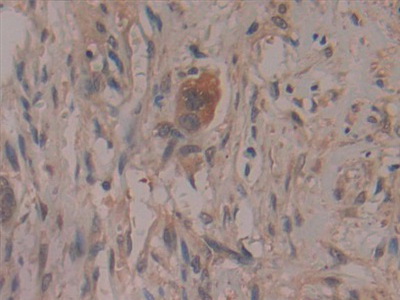 Polyclonal Antibody to Cyclooxygenase-2 (COX 2)