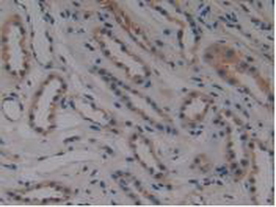 Polyclonal Antibody to Membrane Protein, Palmitoylated 6 (MPP6)