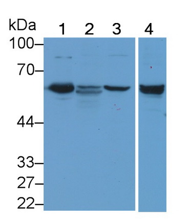 Polyclonal Antibody to Membrane Protein, Palmitoylated 6 (MPP6)