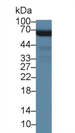 Polyclonal Antibody to Membrane Protein, Palmitoylated 6 (MPP6)