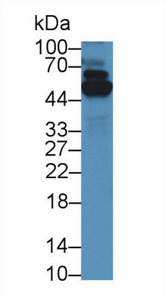 Polyclonal Antibody to Thioredoxin Reductase 1 (TXNRD1)