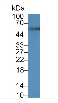 Polyclonal Antibody to Thioredoxin Reductase 1 (TXNRD1)