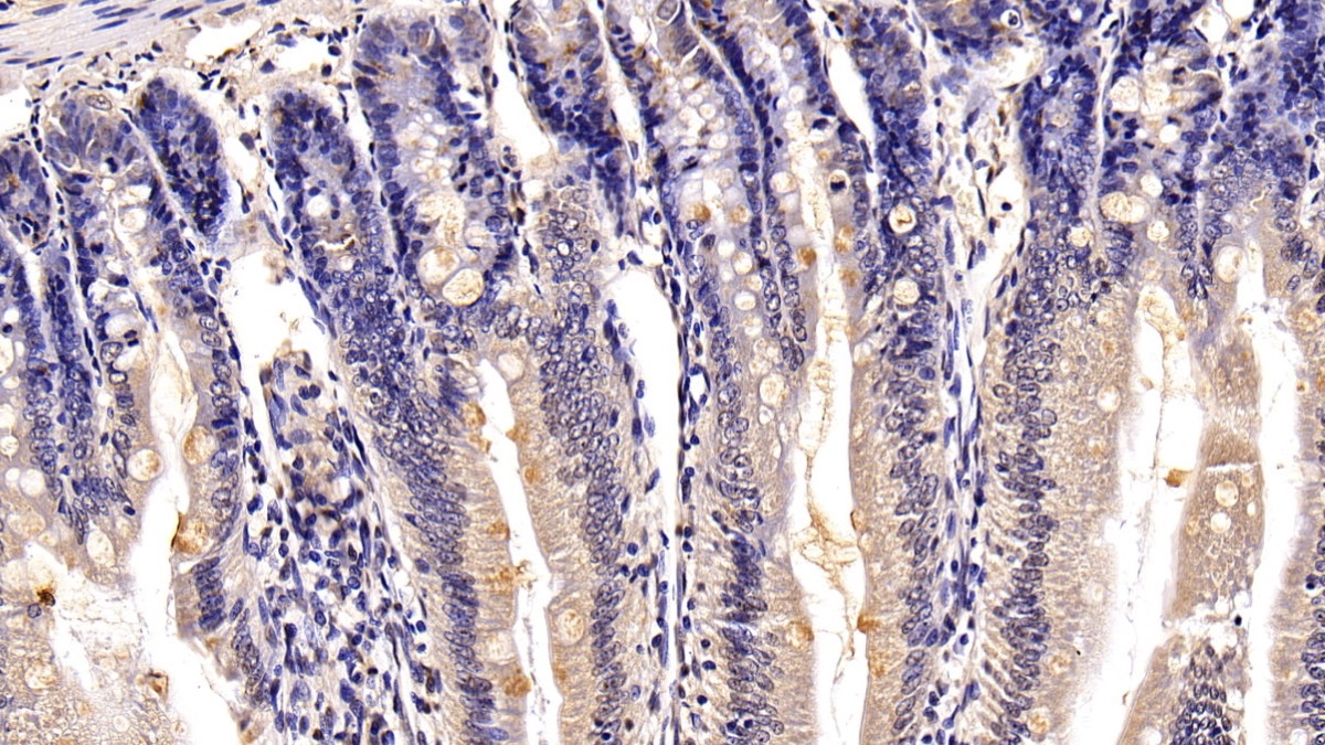 Polyclonal Antibody to Mucin 2 (MUC2)