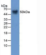 Polyclonal Antibody to Visceral Adipose Tissue Derived Serine Protease Inhibitor (Vaspin)