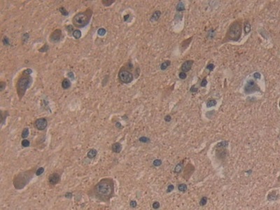 Polyclonal Antibody to Delta-Sleep Inducing Peptide (dSIP)