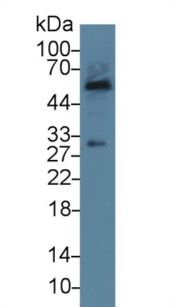 Polyclonal Antibody to Delta-Sleep Inducing Peptide (dSIP)