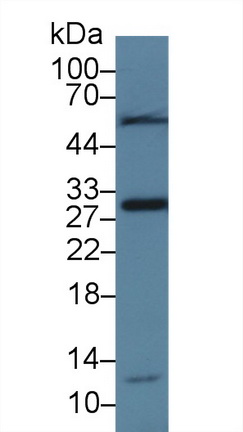 Polyclonal Antibody to Delta-Sleep Inducing Peptide (dSIP)