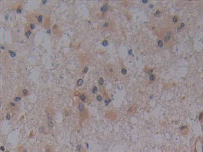 Polyclonal Antibody to Toll Like Receptor 9 (TLR9)