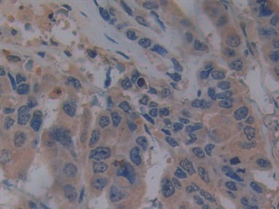 Polyclonal Antibody to Toll Like Receptor 9 (TLR9)