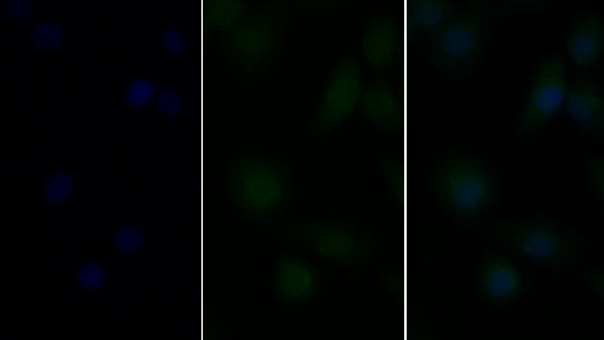 Polyclonal Antibody to Toll Like Receptor 9 (TLR9)