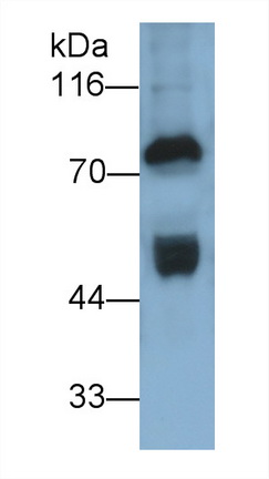 Polyclonal Antibody to Prothrombin Fragment 1+2 (F1+2)