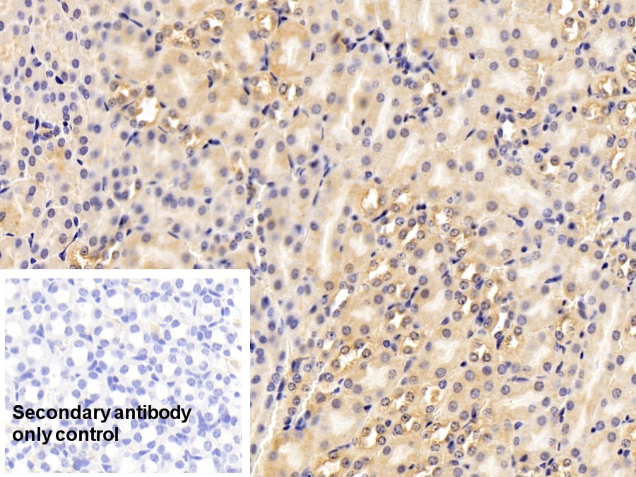 Polyclonal Antibody to Prothrombin Fragment 1+2 (F1+2)