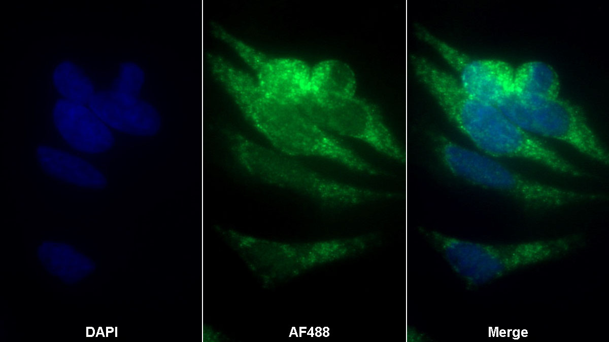 Polyclonal Antibody to Prothrombin Fragment 1+2 (F1+2)