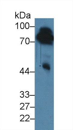 Polyclonal Antibody to Prothrombin Fragment 1+2 (F1+2)