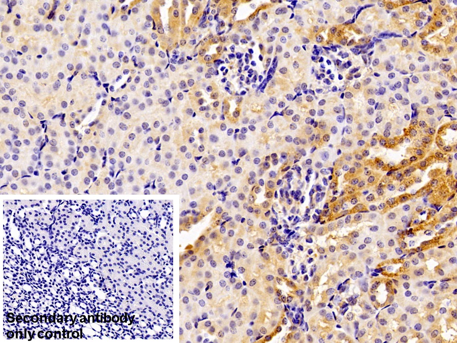 Polyclonal Antibody to Prothrombin Fragment 1+2 (F1+2)