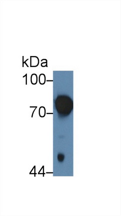 Polyclonal Antibody to Prothrombin Fragment 1+2 (F1+2)