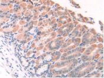 Polyclonal Antibody to Heparanase (HPSE)