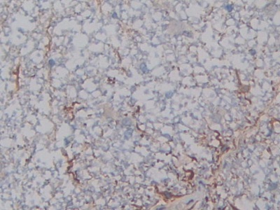 Polyclonal Antibody to Heparanase (HPSE)