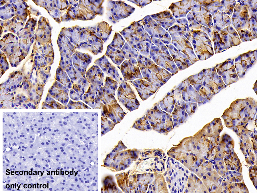 Polyclonal Antibody to Sodium/potassium Transporting ATPase Subunit Beta-3 (ATP1b3)