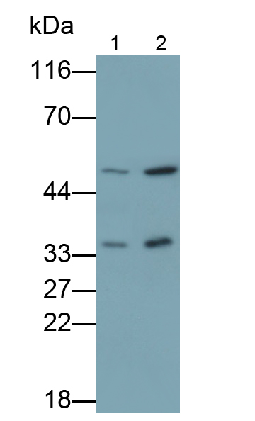 Polyclonal Antibody to Sodium/potassium Transporting ATPase Subunit Beta-3 (ATP1b3)