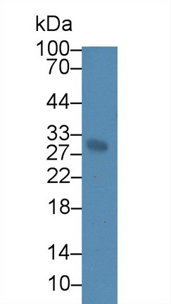 Polyclonal Antibody to Sodium/potassium Transporting ATPase Subunit Beta-3 (ATP1b3)