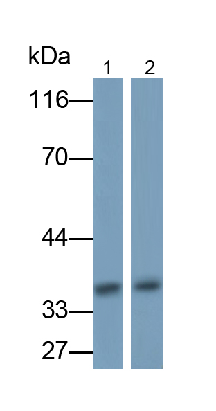 Polyclonal Antibody to CCAAT/Enhancer Binding Protein Beta (CEBPb)