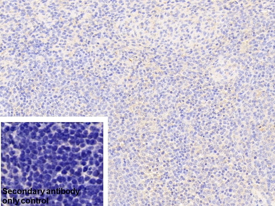 Polyclonal Antibody to Glucose-6-phosphate Dehydrogenase (G6PD)