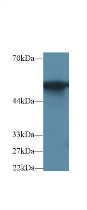 Polyclonal Antibody to Glucose-6-phosphate Dehydrogenase (G6PD)