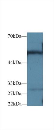 Polyclonal Antibody to Glucose-6-phosphate Dehydrogenase (G6PD)