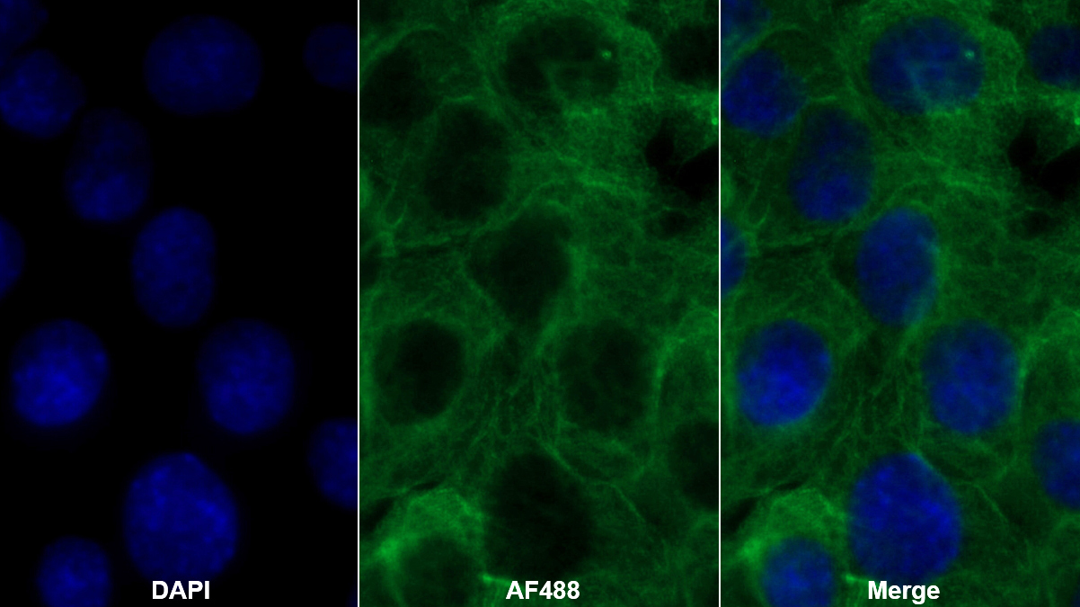 Polyclonal Antibody to Glucose-6-phosphate Dehydrogenase (G6PD)