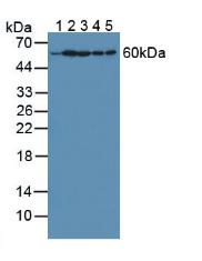 Polyclonal Antibody to Hypoxanthine Phosphoribosyltransferase 1 (HPRT1)