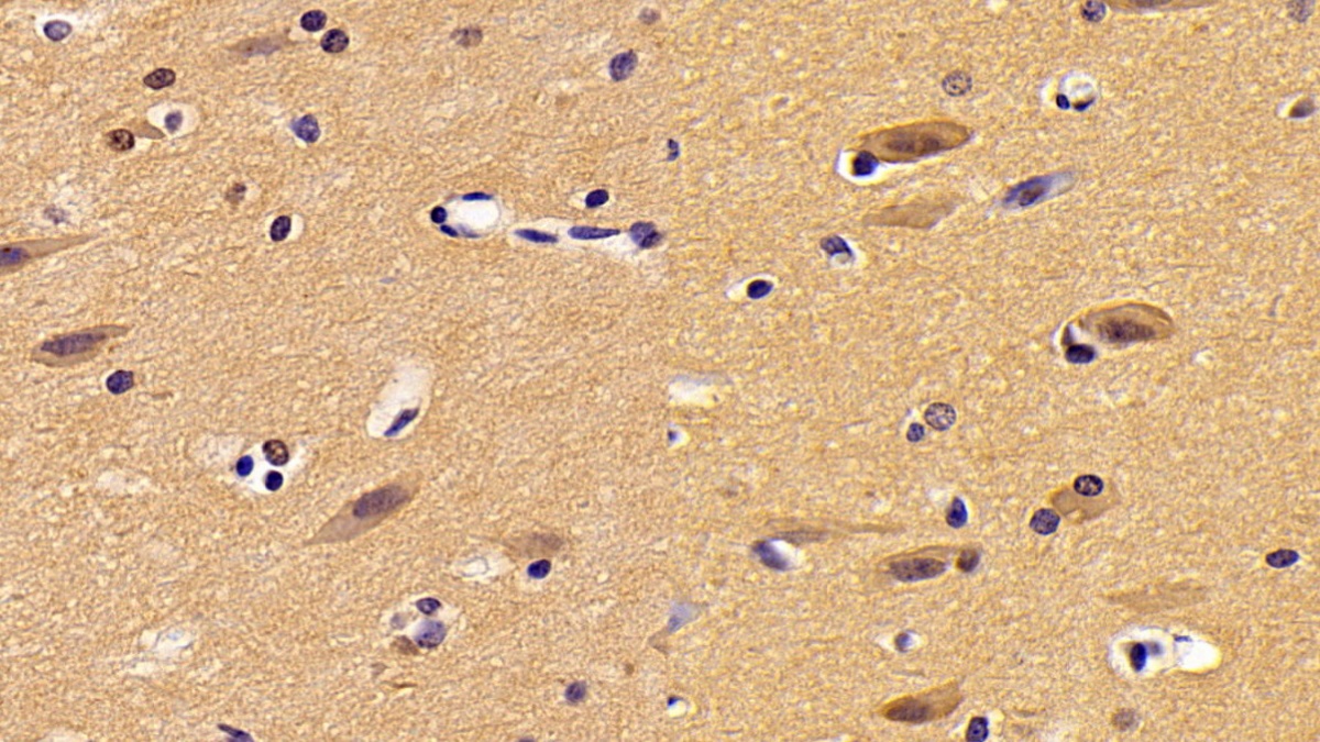 Polyclonal Antibody to Hypoxanthine Phosphoribosyltransferase 1 (HPRT1)