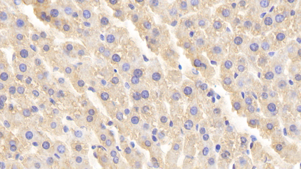 Polyclonal Antibody to Beta-Site APP Cleaving Enzyme 1 (bACE1)