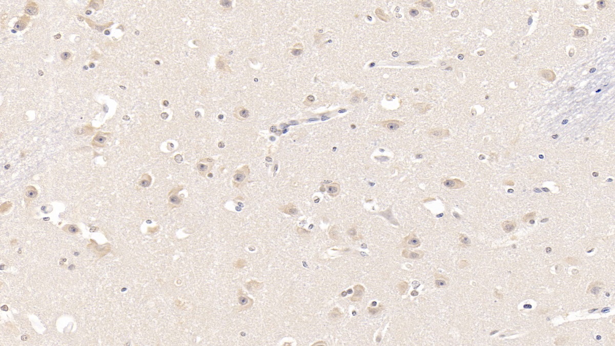 Polyclonal Antibody to G Protein Coupled Receptor 44 (GPR44)