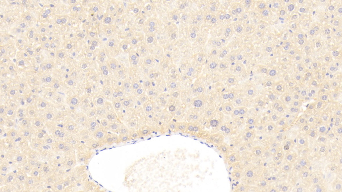 Polyclonal Antibody to Glucose 6 Phosphate Isomerase (GPI)