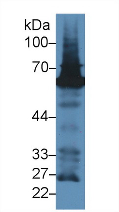 Polyclonal Antibody to Glucose 6 Phosphate Isomerase (GPI)