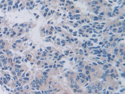 Polyclonal Antibody to Prealbumin (PALB)