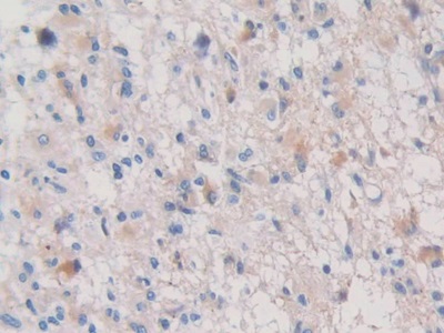 Polyclonal Antibody to Prealbumin (PALB)