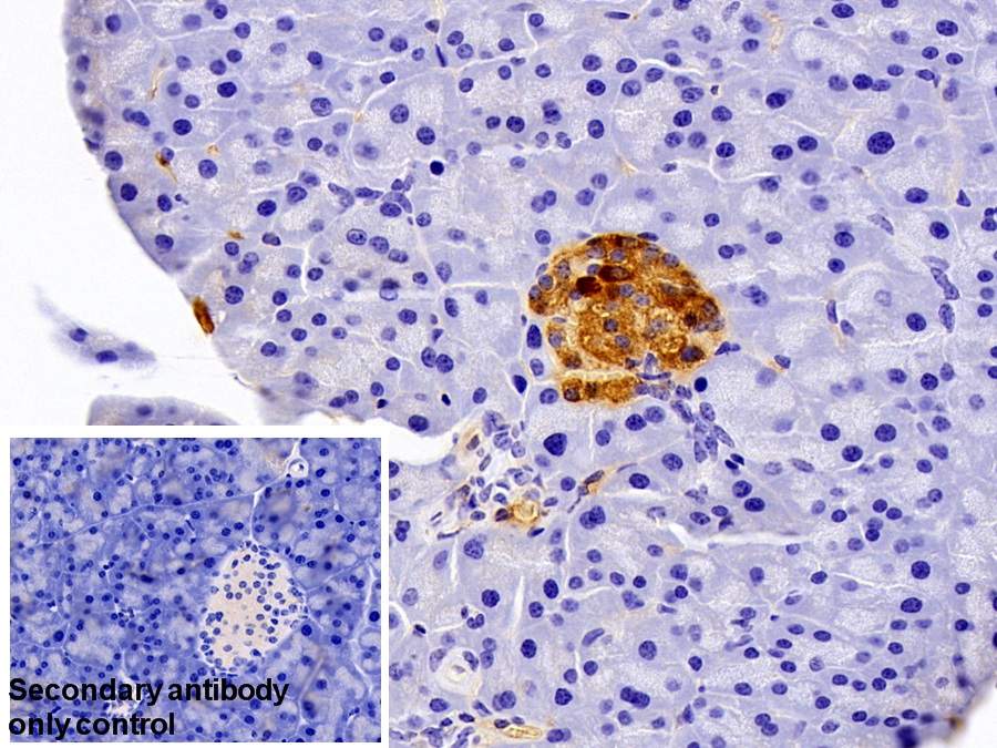 Polyclonal Antibody to Prealbumin (PALB)