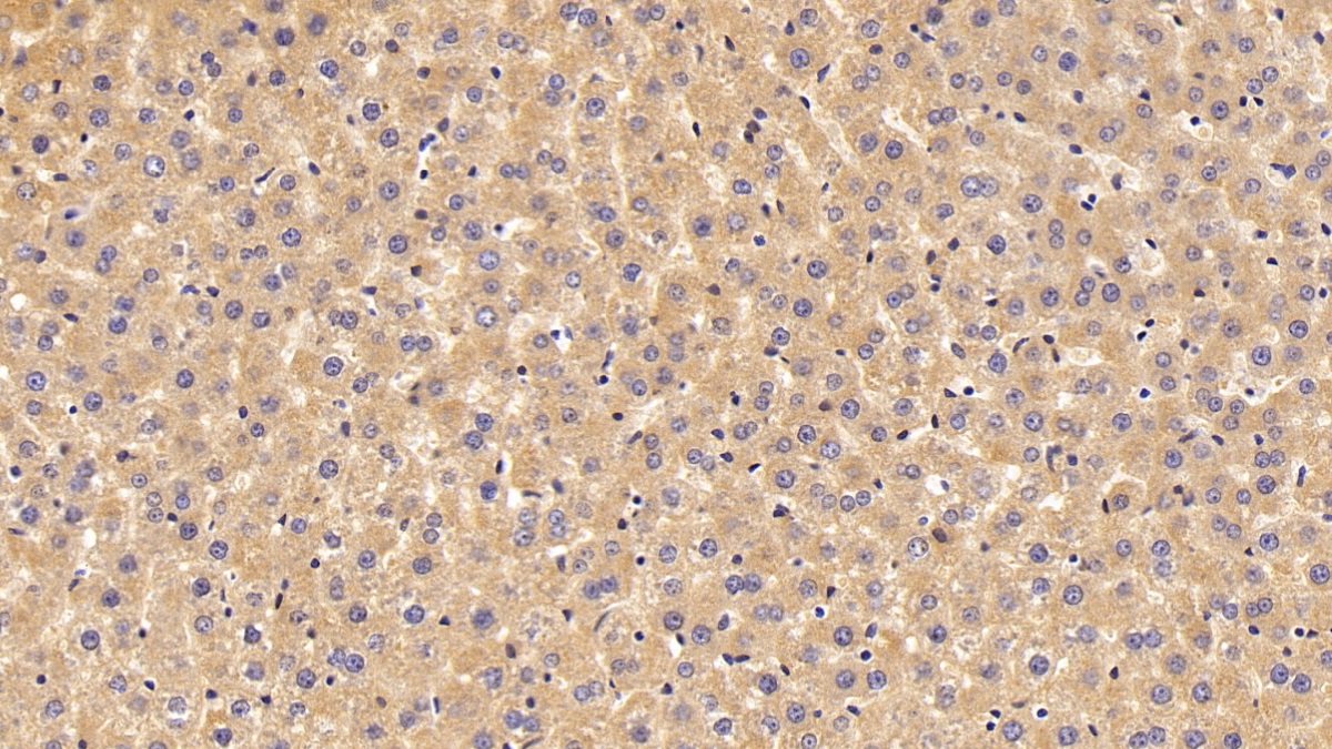 Polyclonal Antibody to Prealbumin (PALB)