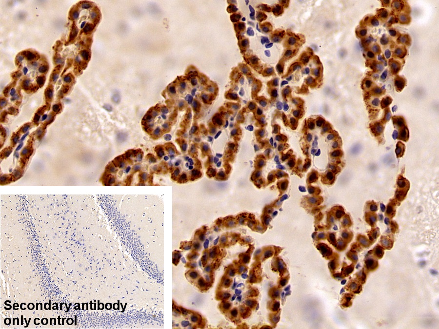 Polyclonal Antibody to Prealbumin (PALB)