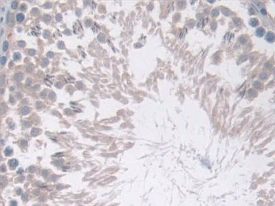 Polyclonal Antibody to Cyclooxygenase 1 (COX-1)