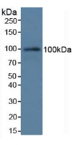 Polyclonal Antibody to Complement Component 7 (C7)