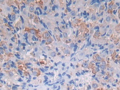 Polyclonal Antibody to Protein Z (PROZ)