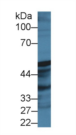 Polyclonal Antibody to Prostaglandin I Synthase (PTGIS)