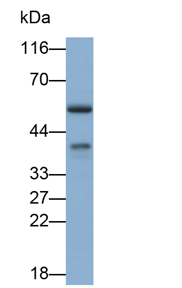 Polyclonal Antibody to Dickkopf Related Protein 1 (DKK1)