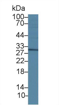 Polyclonal Antibody to Dickkopf Related Protein 1 (DKK1)