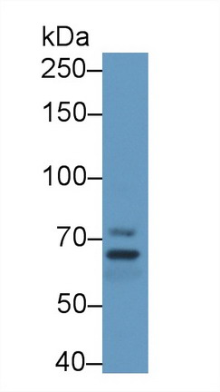 Polyclonal Antibody to Membrane Protein, Palmitoylated 5 (MPP5)